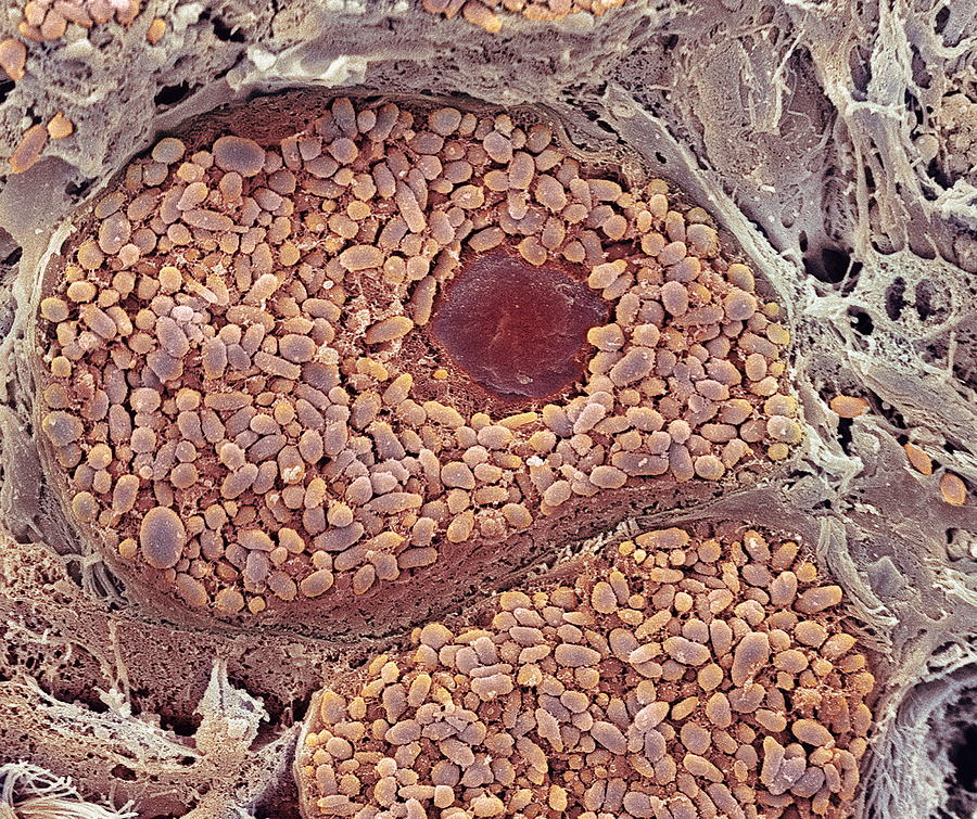 Choroid Layer Of The Eye Sem Photograph By Steve Gschmeissner