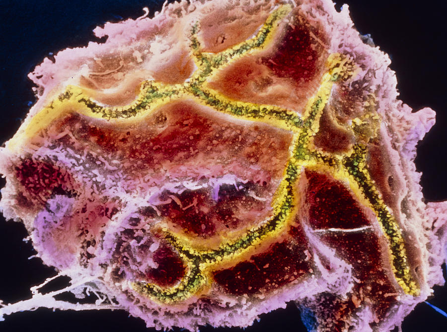 Coloured Sem Of A Liver Cell Known As Hepatocyte Photograph By