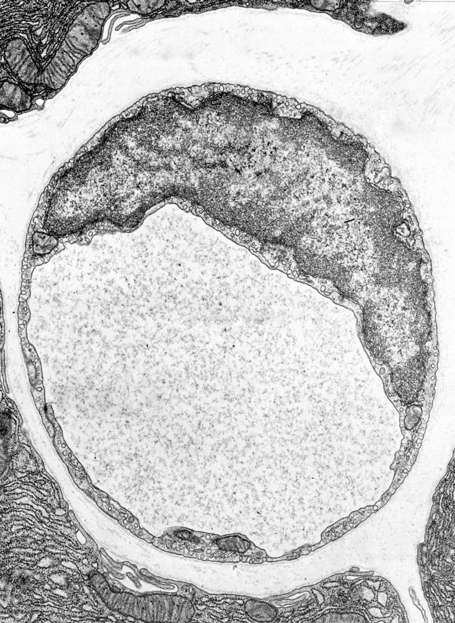 Electron Micrograph Of A Continuous Capillary Photograph By Cultura Sciencealvin Telser Phd 4484