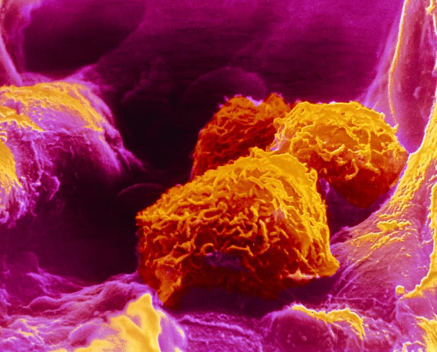 False Colour Sem Of Three Macrophages In Lung Photograph By Cnri Photo