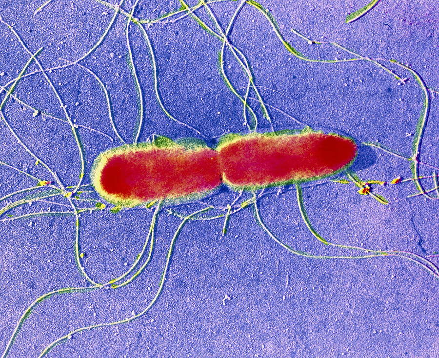Why Are Salmonella Typhi