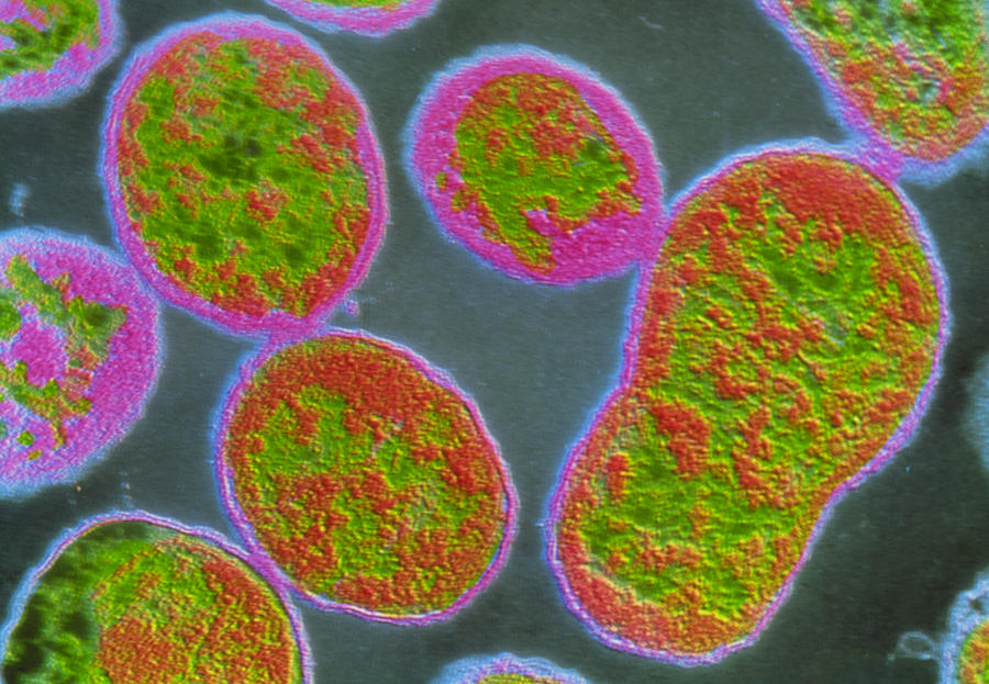 F Colour Tem Of Brucella Abortus Bacteria Photograph By Cnri