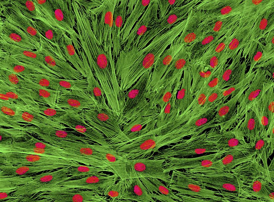 Fibroblast Cells Light Micrograph Photograph By Thomas Deerinck Ncmir