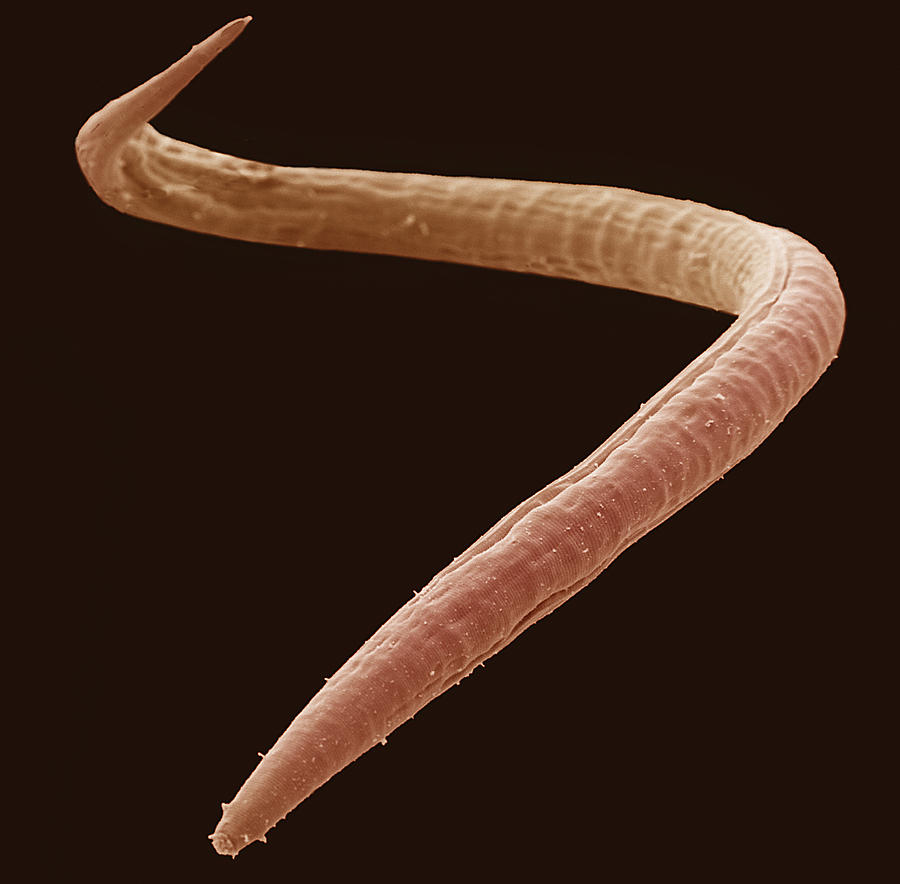 Montessori Biology Phylum Nematoda Pinegreenwoods