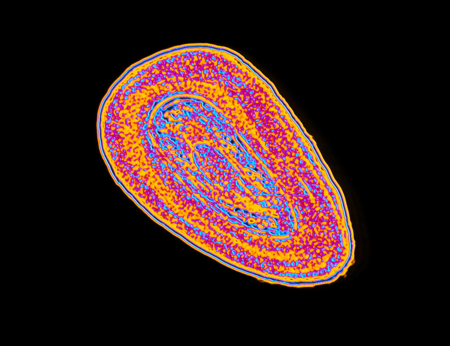 Haemophilus Influenzae B Bacterium Photograph By Pasieka