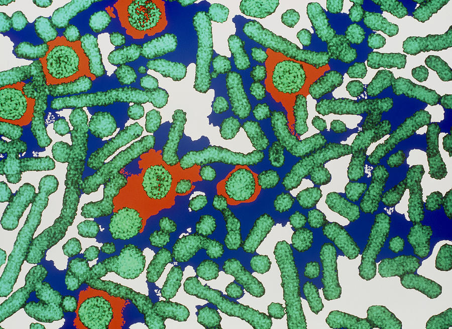 Hepatitis B Viruses Photograph By Dr Linda Stannard Uct Fine Art America