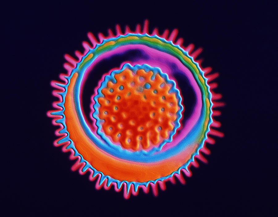 Herpes Simplex Virus Photograph By Pasieka Fine Art America