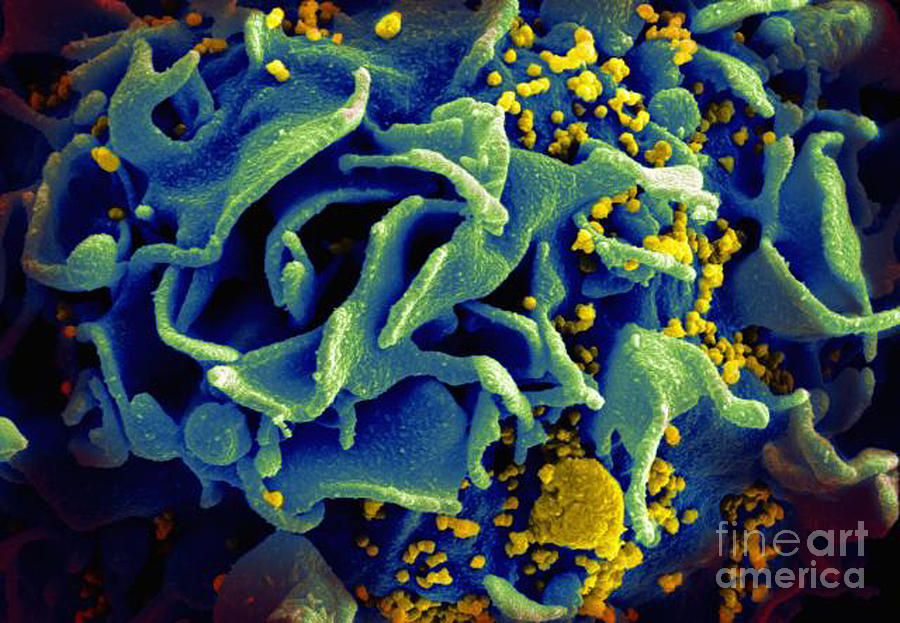 Hiv Sem