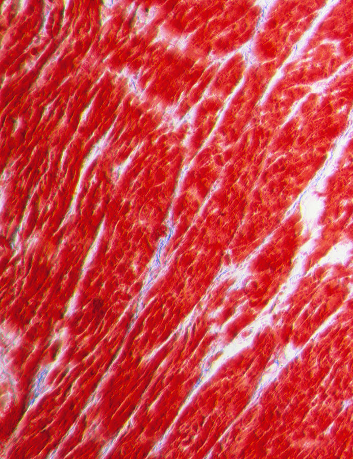 Light Micrograph Of Normal Heart Cardiac Muscle Photograph By Pasieka