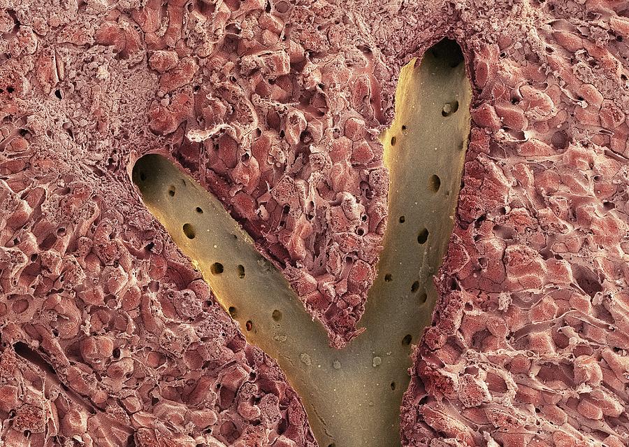 Liver Vein Sem Photograph By Thomas Deerinck Ncmir Fine Art America