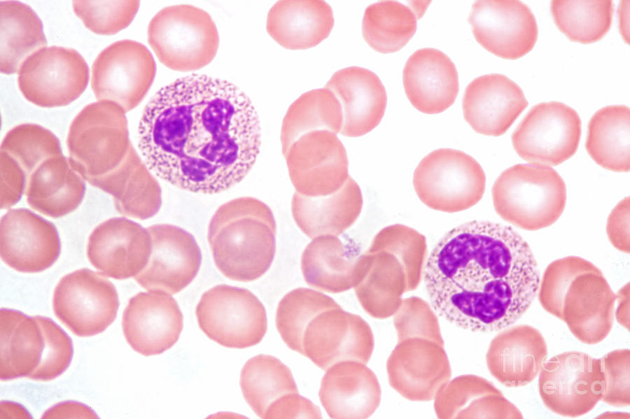 Neutrophils In Peripheral Blood Smear By M. I. Walker