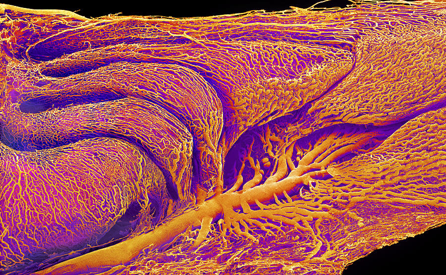 Rat S Nose And Blood Vessels Sem Photograph By Susumu Nishinaga Fine