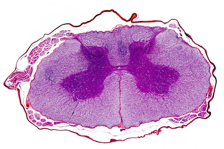 Spinal Cord, Transverse Section Photograph by Dr Keith Wheeler