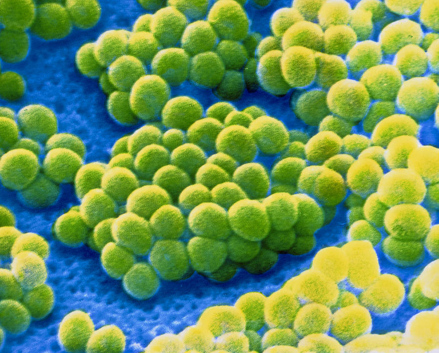 Pictures Of The Bacteria Staphylococcus Aureus 56