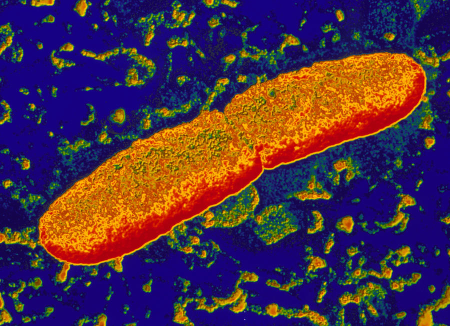 Image result for yersinia pestis