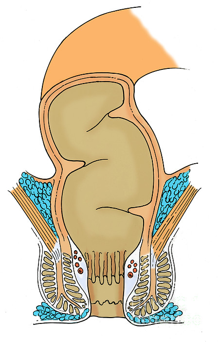 Illustration Of Rectum by Science Source
 Rectum Drawing