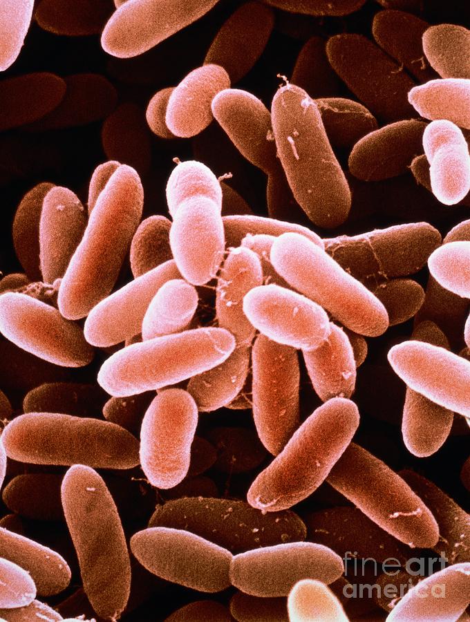 Listeria Monocytogenes Bacteria Photograph By Steve Lowry Science Photo