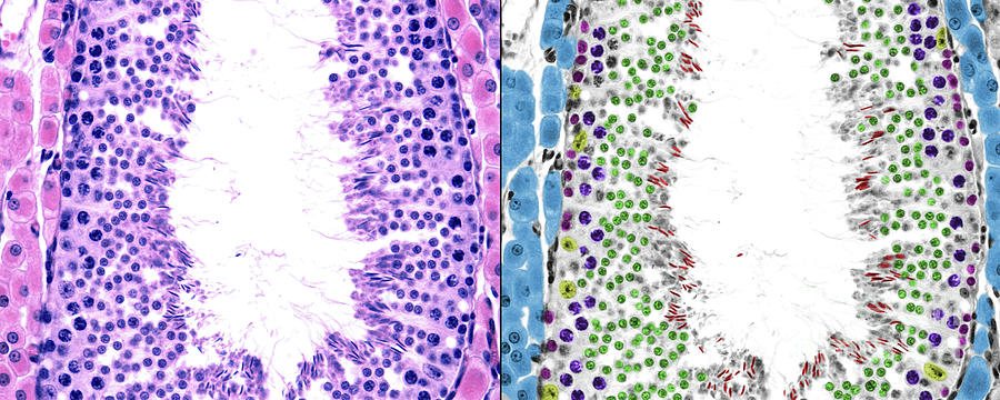 Seminiferous Tubules And Leydig Cells 1 Photograph By Jose Calvo