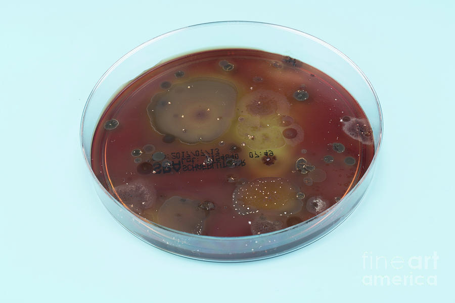 Microbes Growing On Agar Plate Photograph By Wladimir Bulgar Science