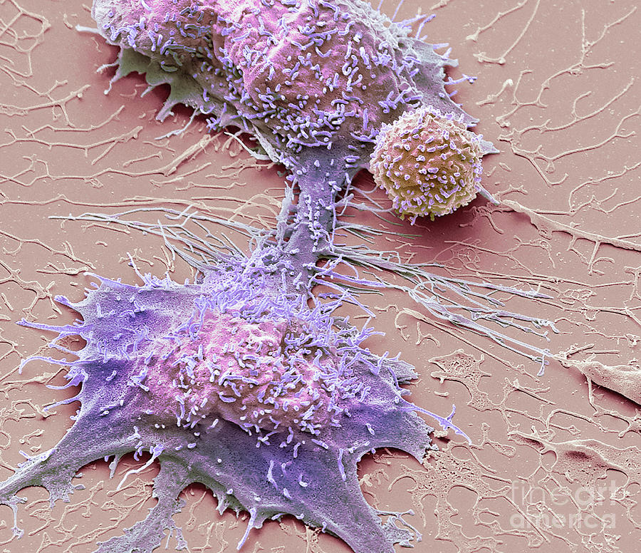 Natural Killer Cell And Cancer Cell Photograph By Steve Gschmeissner