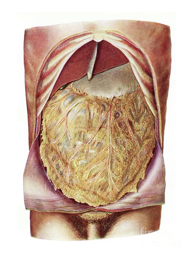 Abdominal Organs Photograph By Microscape Science Photo Library Pixels