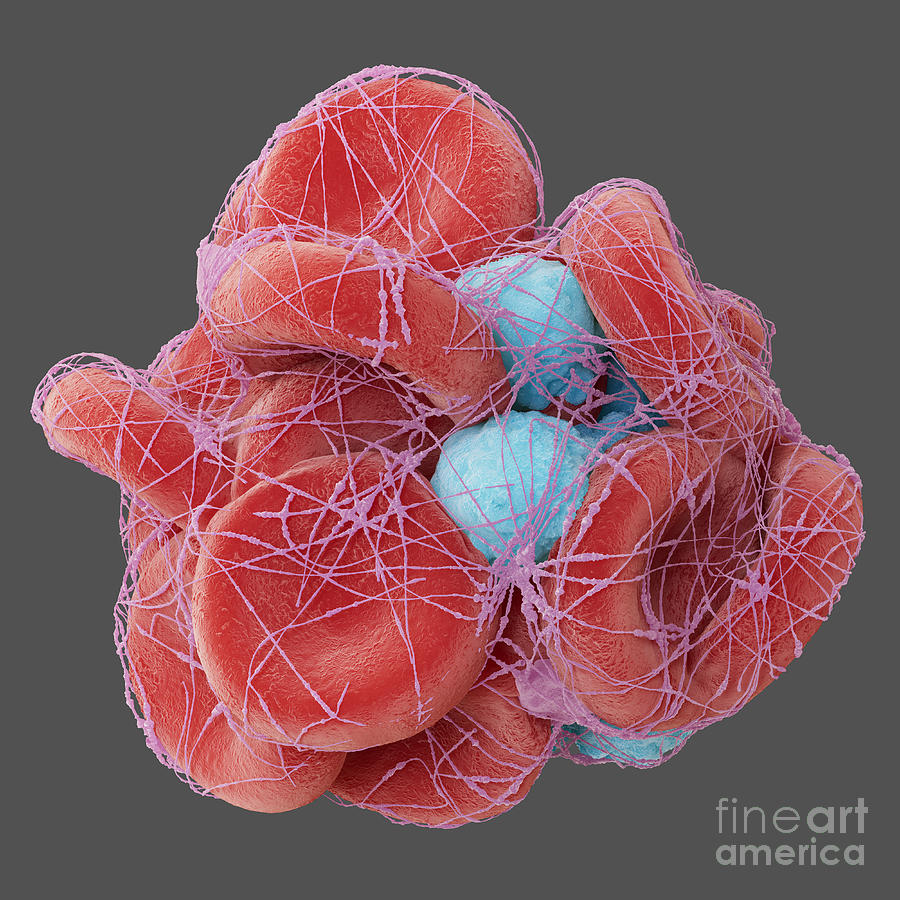 Blood Clot 2 By Thom Leach Science Photo Library