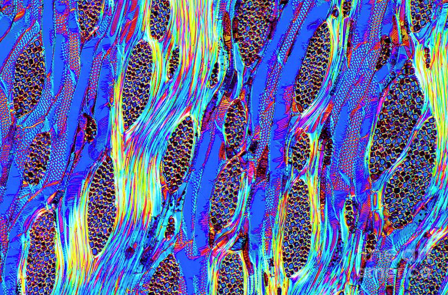 Elm Stem By Dr Keith Wheeler Science Photo Library