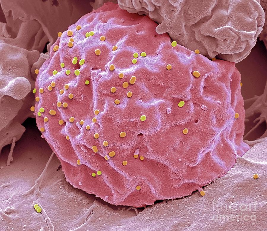 Hiv Viral Vector 2 By Steve Gschmeissner Science Photo Library