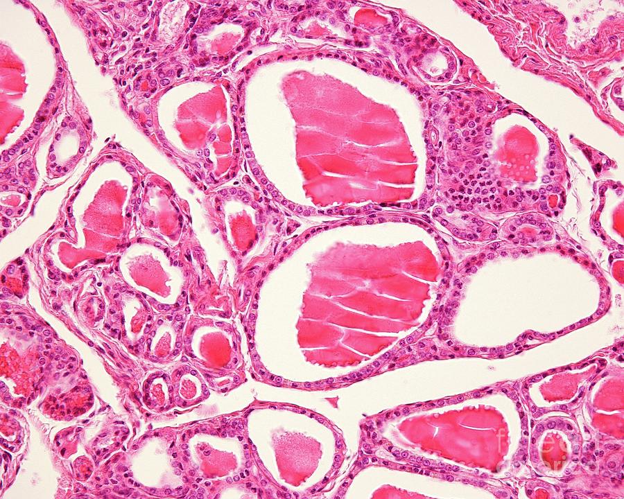 Human Thyroid Gland Follicles Photograph By Jose Calvo Science Photo