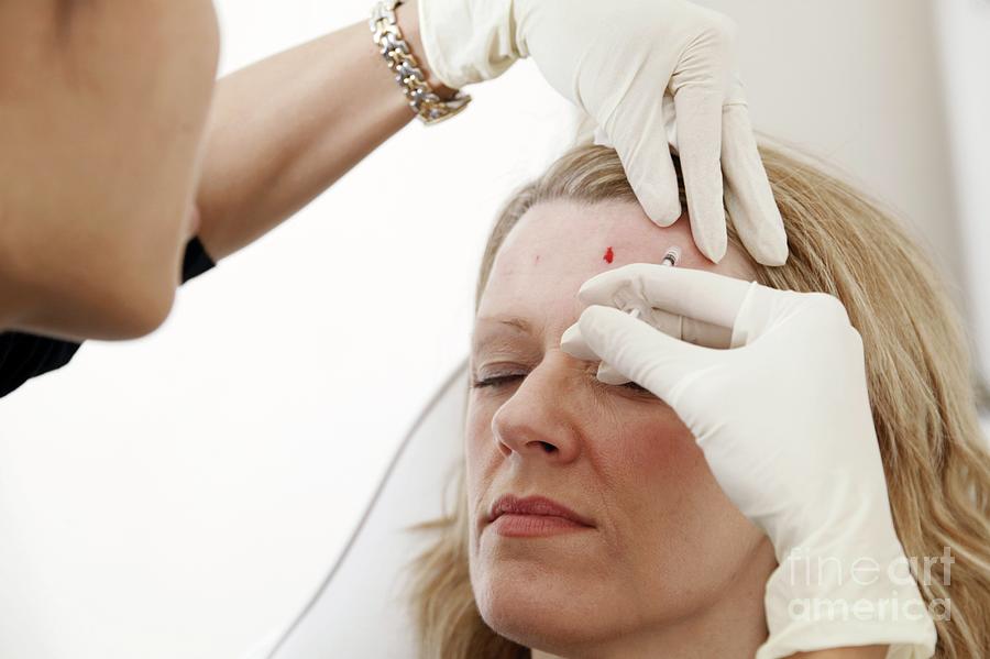 Botox Treatment By Michael Donne Science Photo Library