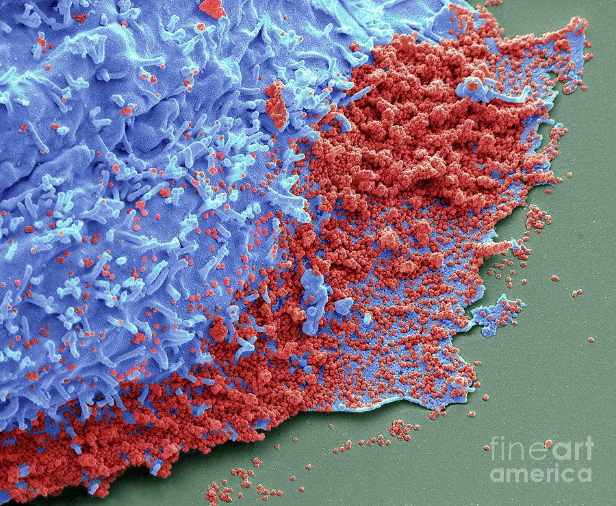 Delta Variant Of Sars Cov Photograph By Steve Gschmeissner Science