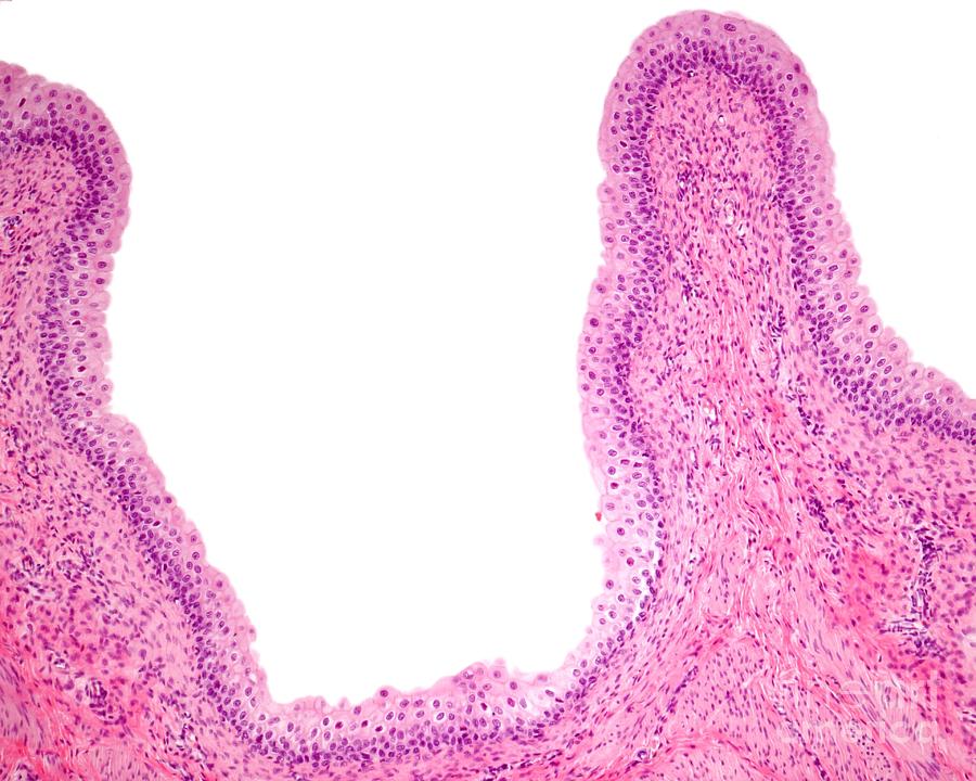 Urinary Bladder Mucosa Photograph By Jose Calvo Science Photo Library