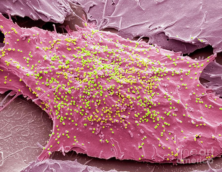 Siv Infected Cells Photograph By Steve Gschmeissner Science Photo