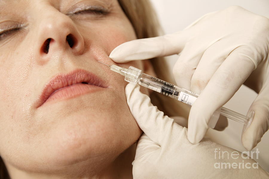 Restylane Treatment Photograph By Michael Donne Science Photo Library