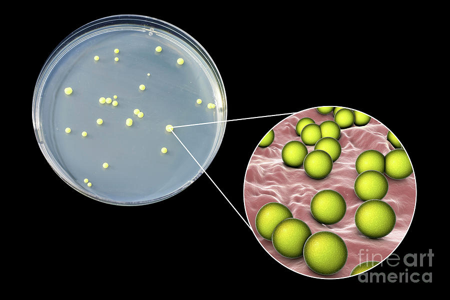 Micrococcus Luteus Bacteria 8 By Kateryna Kon Science Photo Library