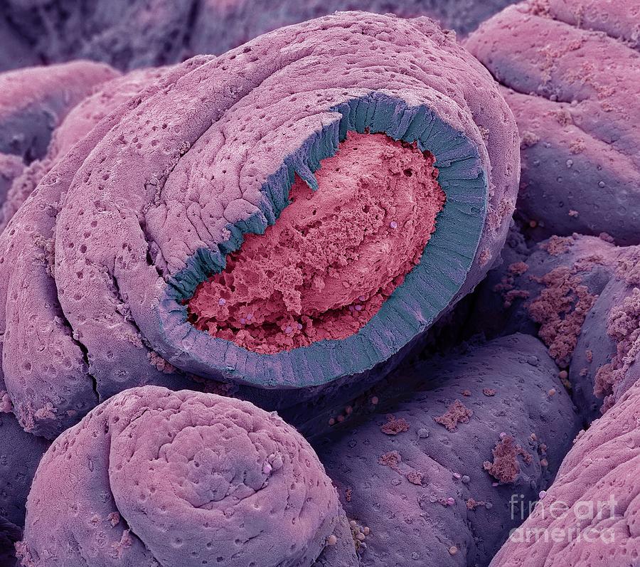 Small Intestine Photograph By Steve Gschmeissner Science Photo Library