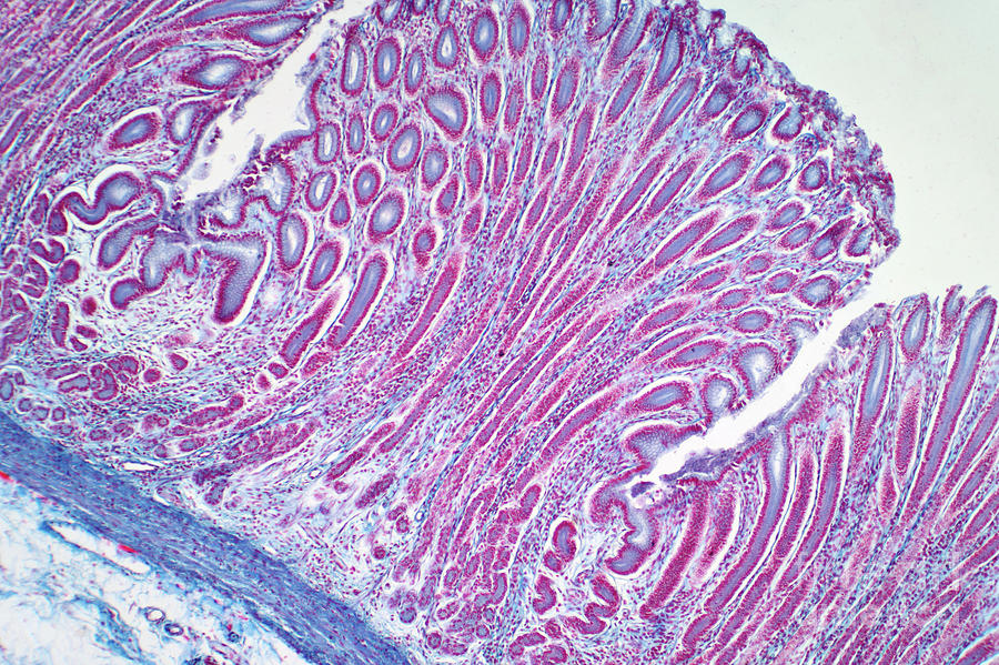 Colon Biopsy Photograph By Choksawatdikorn Science Photo Library Pixels