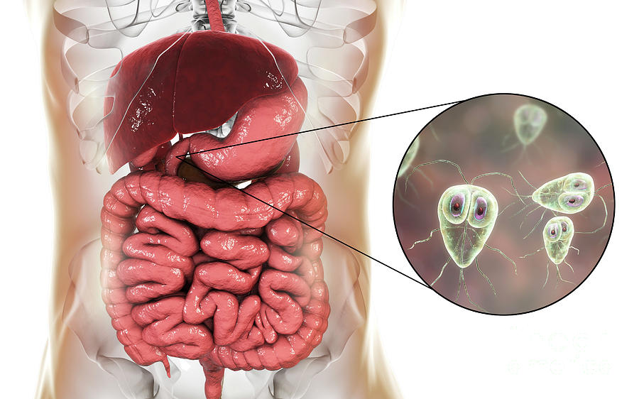 Giardia Lamblia In Human Duodenum Photograph By Kateryna Kon Science