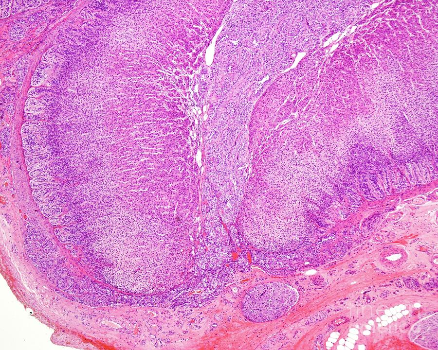 Human Adrenal Medulla By Jose Calvo Science Photo Library