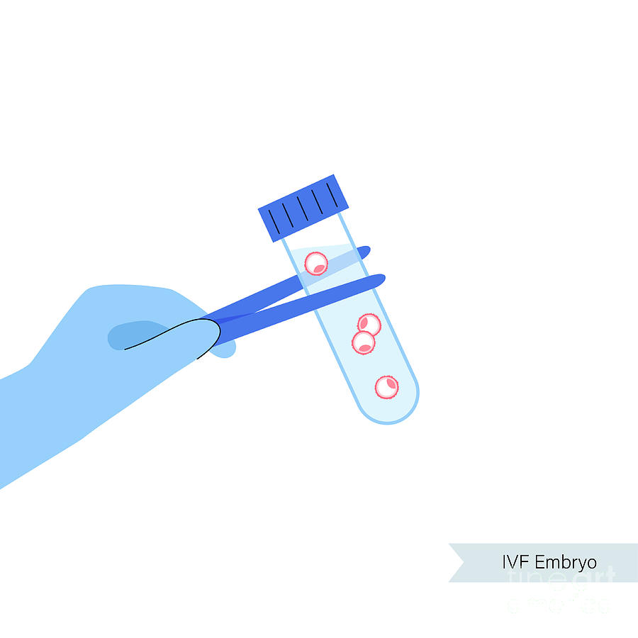 Ivf Embryos By Pikovit Science Photo Library