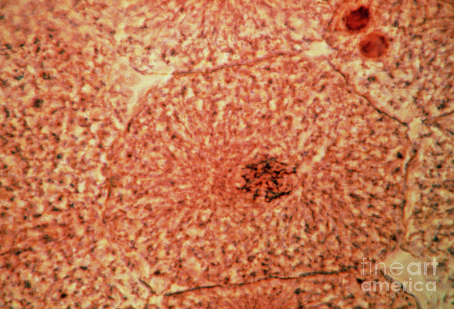 Lm Of Whitefish Cell About To Undergo Mitosis Photograph By Eric Grave