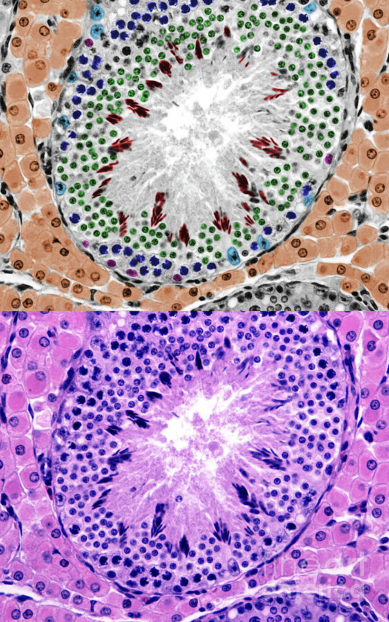 Seminiferous Tubule And Leydig Cells By Jose Calvo Science Photo Library