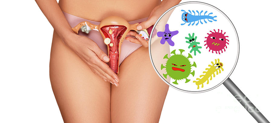 Sexually Transmitted Infections Photograph By Peakstock Science Photo