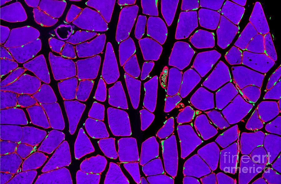 Skeletal Muscle Fibres By Thomas Deerinck Ncmir Science Photo Library