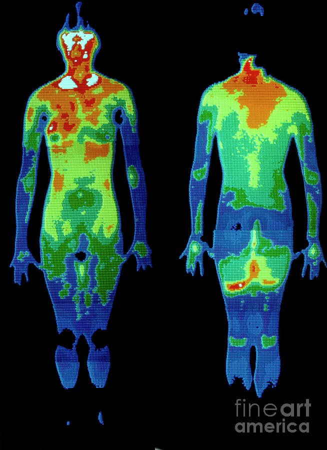 Thermogram Naked Woman Standing By Science Photo Library