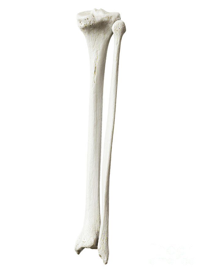 Tibia And Fibula Photograph By Sebastian Kaulitzki Science Photo