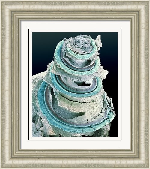 Dr David Furness, Keele University - Organ Of Corti, Inner Ear... Print Dr David Furness, Keele University - Organ Of Corti, Inner Ear... Print