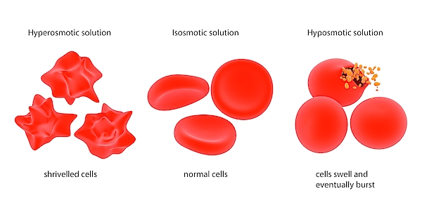 Osmosis In Red Blood Cells Greeting Card by Science Photo Library