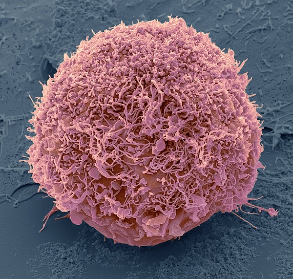 Mesenchymal Stem Cell, Sem by Science Photo Library