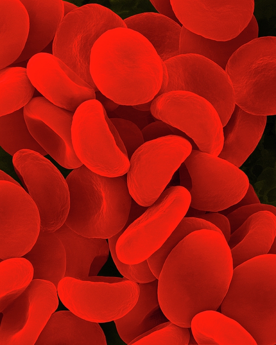 Red Blood Cells In Hypotonic Solution #8 Greeting Card by Dennis Kunkel ...